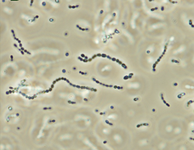 Streptococcus_iniae.png